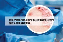 北京中医医院银屑病专家门诊怎么样 北京中医药大学银屑病专家