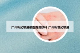 广州新纪银屑病医院皮肤科 广州新世纪银屑