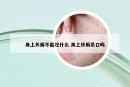 身上长癣不能吃什么 身上长癣忌口吗