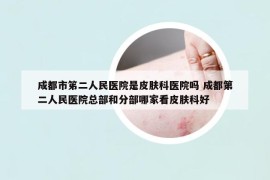 成都市笫二人民医院是皮肤科医院吗 成都第二人民医院总部和分部哪家看皮肤科好