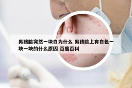 男孩脸突然一块白为什么 男孩脸上有白色一块一块的什么原因 百度百科