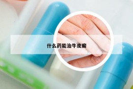 什么药能治牛皮廨