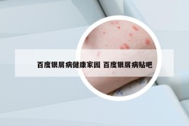 百度银屑病健康家园 百度银屑病贴吧