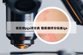 银屑病pga评分表 银屑病评分标准iga