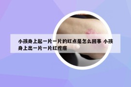 小孩身上起一片一片的红点是怎么回事 小孩身上出一片一片红疙瘩