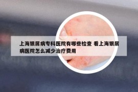 上海银屑病专科医院有哪些检查 看上海银屑病医院怎么减少治疗费用