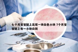 七个月宝宝腿上出现一块白色小块 7个月宝宝腿上有一小块白斑