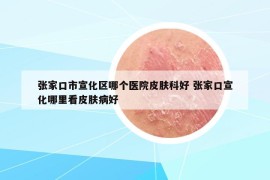 张家口市宣化区哪个医院皮肤科好 张家口宣化哪里看皮肤病好