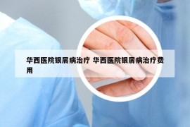 华西医院银屑病治疗 华西医院银屑病治疗费用