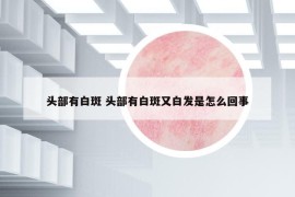 头部有白斑 头部有白斑又白发是怎么回事