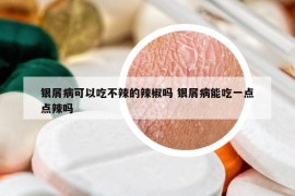 银屑病可以吃不辣的辣椒吗 银屑病能吃一点点辣吗