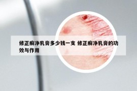 修正癣净乳膏多少钱一支 修正癣净乳膏的功效与作用