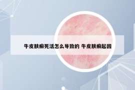 牛皮肤癣死活怎么导致的 牛皮肤癣起因