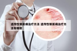 遗传性银屑病治疗方法 遗传性银屑病治疗方法有哪些