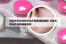 乌鲁木齐比较好的治疗银屑病的医院 乌鲁木齐治疗皮肤病哪家好