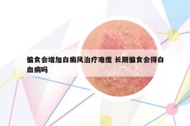 偏食会增加白癜风治疗难度 长期偏食会得白血病吗