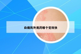 白癜风外用药哪个见效快