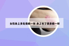 女性身上多处像癣一样 身上长了很多癣一样