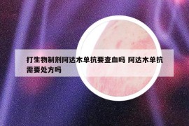 打生物制剂阿达木单抗要查血吗 阿达木单抗需要处方吗