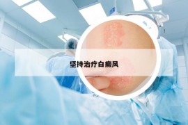 坚持治疗白癜风