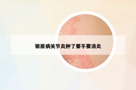 银屑病关节炎肿了要不要消炎