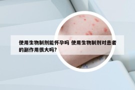 使用生物制剂能怀孕吗 使用生物制剂对患者的副作用很大吗?