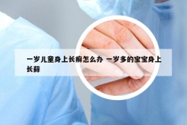 一岁儿童身上长癣怎么办 一岁多的宝宝身上长藓