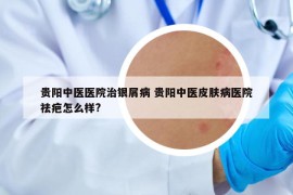 贵阳中医医院治银屑病 贵阳中医皮肤病医院祛疤怎么样?