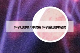 怀孕肚脐眼长牛皮癣 怀孕后肚脐眼起皮