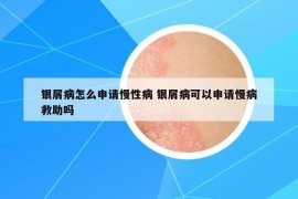 银屑病怎么申请慢性病 银屑病可以申请慢病救助吗