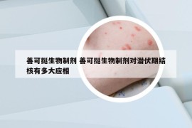 善可挺生物制剂 善可挺生物制剂对潜伏期结核有多大应相