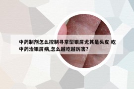 中药制剂怎么控制寻常型银屑尤其是头皮 吃中药治银屑病,怎么越吃越厉害?