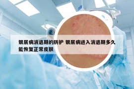 银屑病消退期的防护 银屑病进入消退期多久能恢复正常皮肤