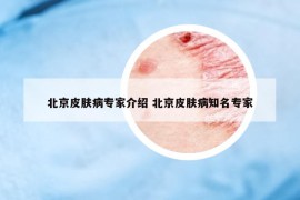 北京皮肤病专家介绍 北京皮肤病知名专家