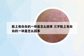 脸上有白白的一块是怎么回事 三岁脸上有白白的一块是怎么回事