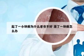 起了一小块癣为什么老也不好 涨了一块癣怎么办