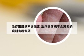 治疗银屑病不含激素 治疗银屑病不含激素的喷剂有哪些药