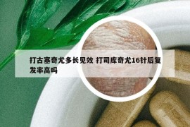 打古塞奇尤多长见效 打司库奇尤16针后复发率高吗