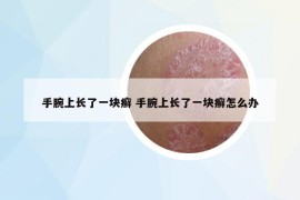 手腕上长了一块癣 手腕上长了一块癣怎么办