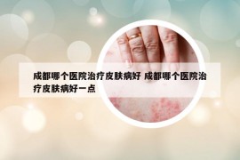 成都哪个医院治疗皮肤病好 成都哪个医院治疗皮肤病好一点