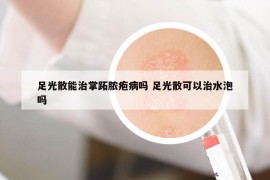 足光散能治掌跖脓疱病吗 足光散可以治水泡吗