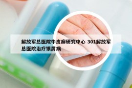 解放军总医院牛皮癣研究中心 301解放军总医院治疗银屑病