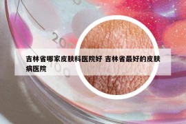 吉林省哪家皮肤科医院好 吉林省最好的皮肤病医院