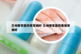 兰州那家医院银霄病好 兰州哪家医院看银屑病好