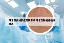 寻常型变成脓疱型银屑病 寻常型脓疱疮临床特点