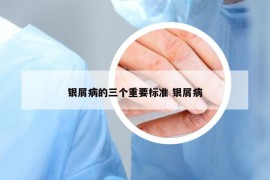 银屑病的三个重要标准 银屑病