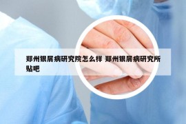 郑州银屑病研究院怎么样 郑州银屑病研究所贴吧