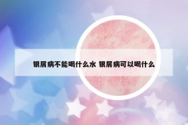 银屑病不能喝什么水 银屑病可以喝什么