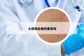 小孩得白癜风要紧吗