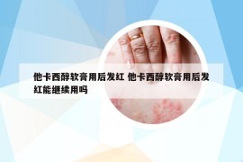 他卡西醇软膏用后发红 他卡西醇软膏用后发红能继续用吗